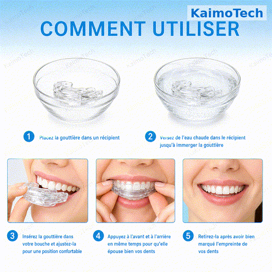 GIF produit KaimoTech pour gouttière anti-ronflement réglable, illustrant la structure flexible, le système de micro-ajustement, la connexion à engrenage et le confort d’adaptation à la bouche pour aider à réduire le ronflement.