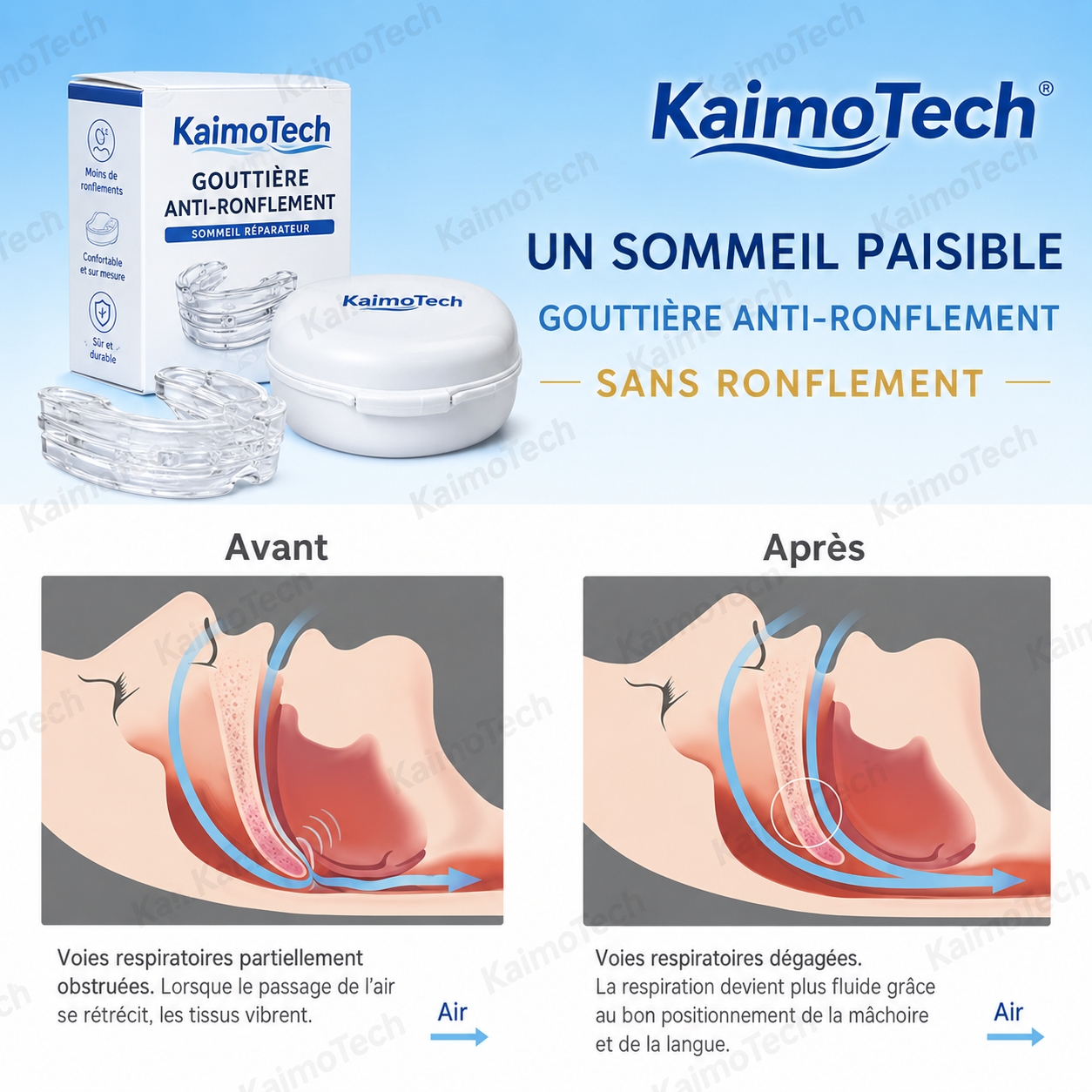 Gouttière anti-ronflement KaimoTech réglable avec visuel avant-après, conçue pour améliorer le confort nocturne, favoriser une respiration plus fluide, aider à réduire le ronflement et accompagner des nuits plus calmes.